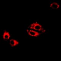 LTA4H / LTA4 Antibody