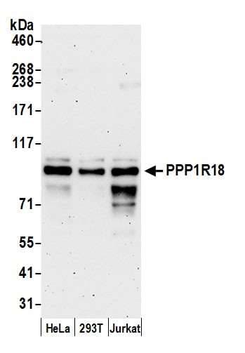 PPP1R18 Antibody (aa325-375)