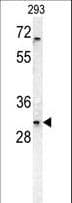 TNFRSF6B / DCR3 Antibody (aa22-48)