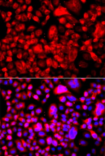 PathPlus™ FASN / Fatty Acid Synthase Antibody