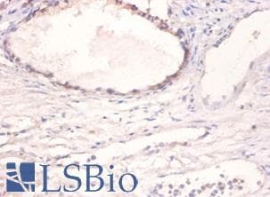 BMP2 Antibody