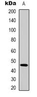 Polyclonal Rabbit anti-Human KRT18 / CK18 / Cytokeratin 18 Antibody (IHC, WB)