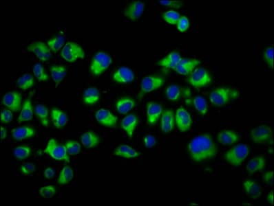 DCYTB / CYBRD1 Antibody