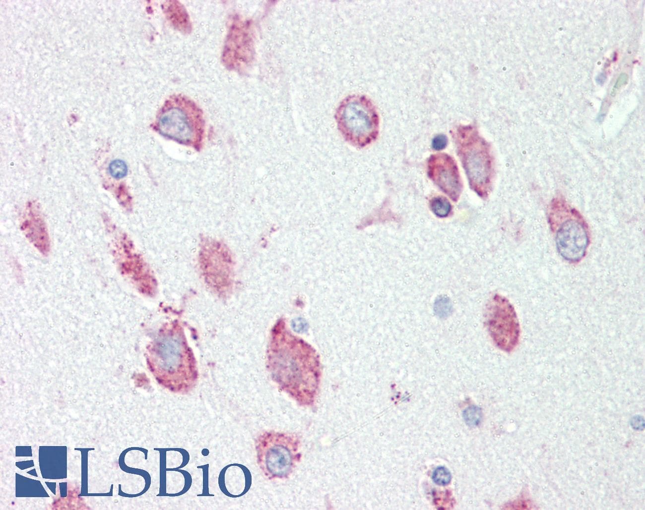 IHC-plus™ HEXA Antibody (aa142-170)