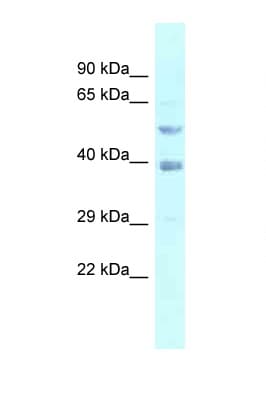 FEN1 Antibody (N-Terminus)