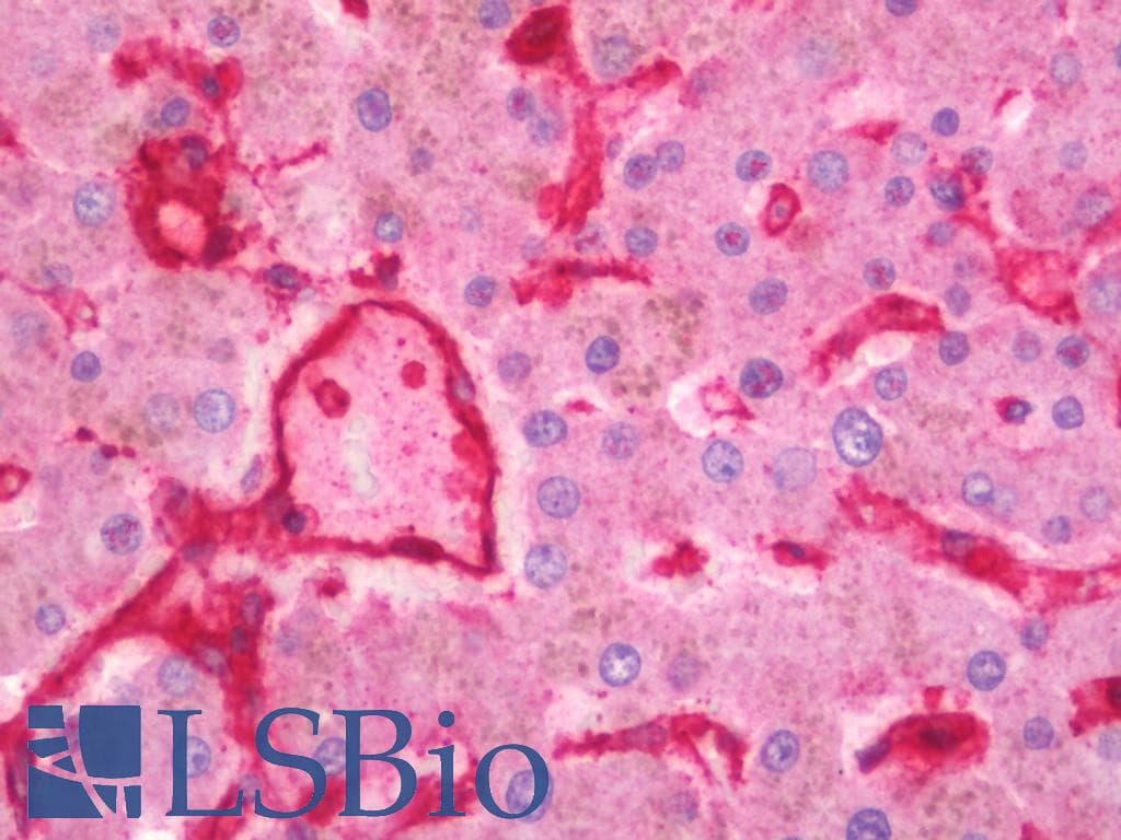 IHC-plus™ Polyclonal Rabbit anti-Human ANXA2 / Annexin A2 Antibody (aa88-137, IHC, WB)