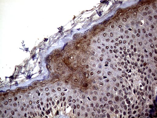 CSA / ERCC8 Antibody (clone OTI5C9)