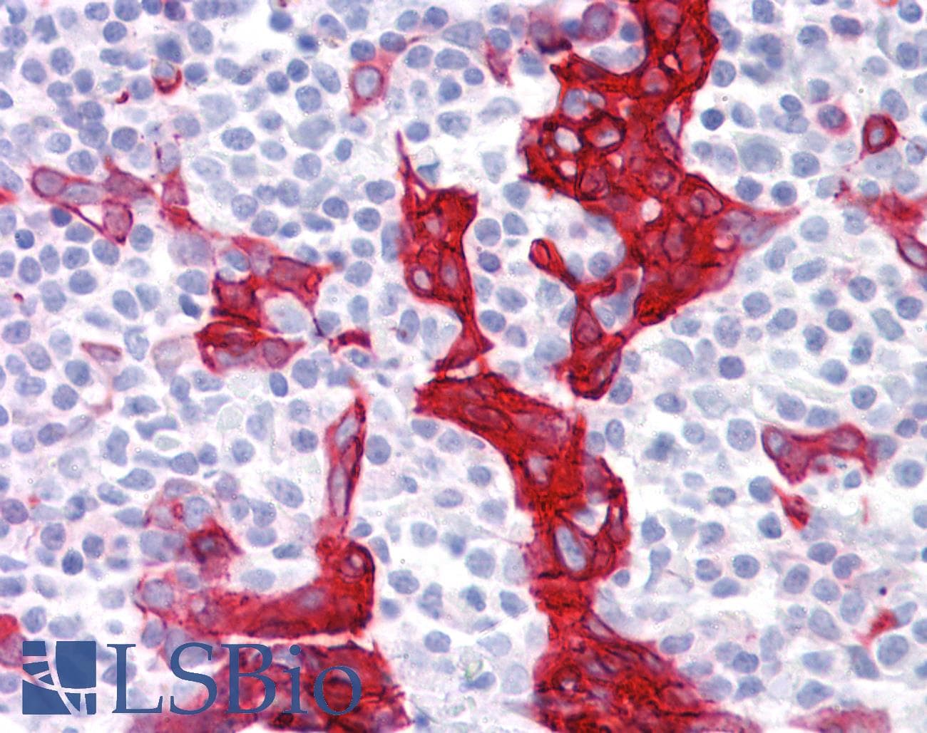 IHC-plus™ Cytokeratin 10+13 Antibody (clone DE-K13)