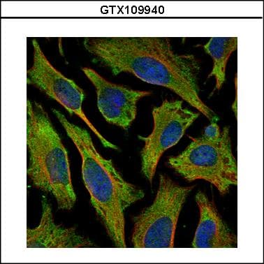 IHC-plus™ VIL1 / Villin Antibody (aa7-246)