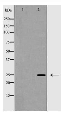 Polyclonal Rabbit anti-Human CD8A / CD8 Alpha Antibody (WB)