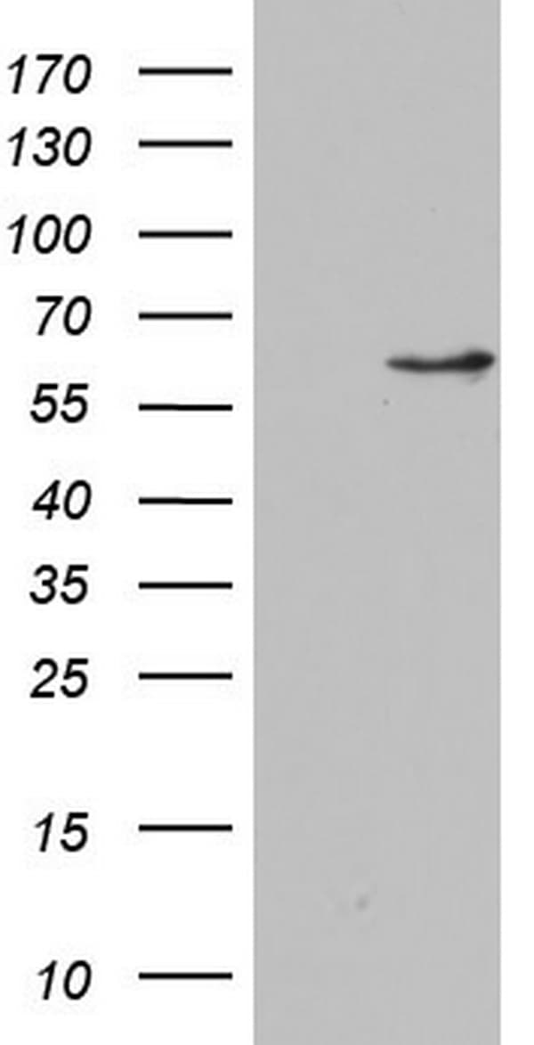 Monoclonal Mouse anti-Human NAE1 / APPBP1 Antibody (clone OTI1D12, aa1-274, WB)