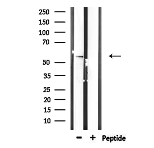 STK38L / NDR2 Antibody