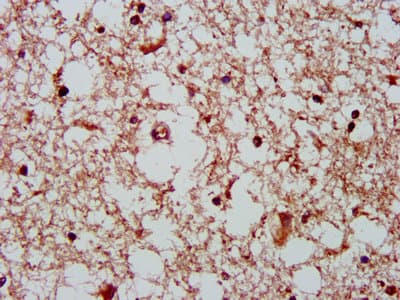 Polyclonal Rabbit anti-Human GHITM Antibody (IHC, WB)