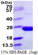 E. coli ppa/Inorganic Pyrophosphatase Protein (Recombinant His)