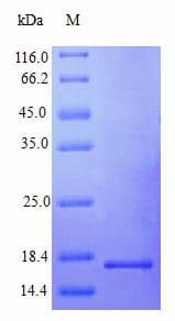 Human IFN Gamma / Interferon Gamma Protein (Recombinant)