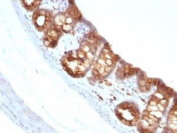Cytokeratin 1+8 Antibody (clone KRT18/1190)