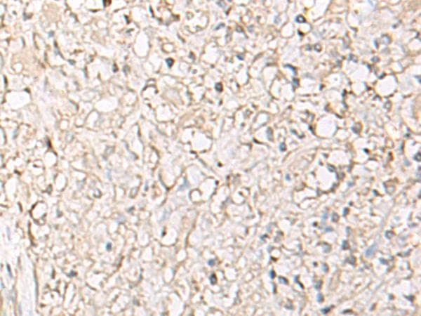 IGHA1 / IgA1 Antibody