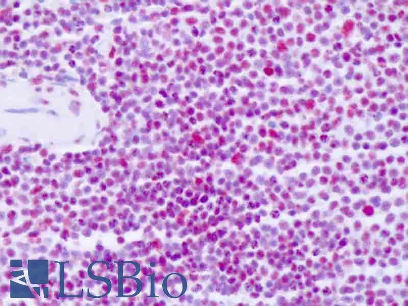 IHC-plus™ Monoclonal Rabbit anti-Human PABPN1 / PABP2 Antibody (clone EP3001Y, Internal, IHC, WB)