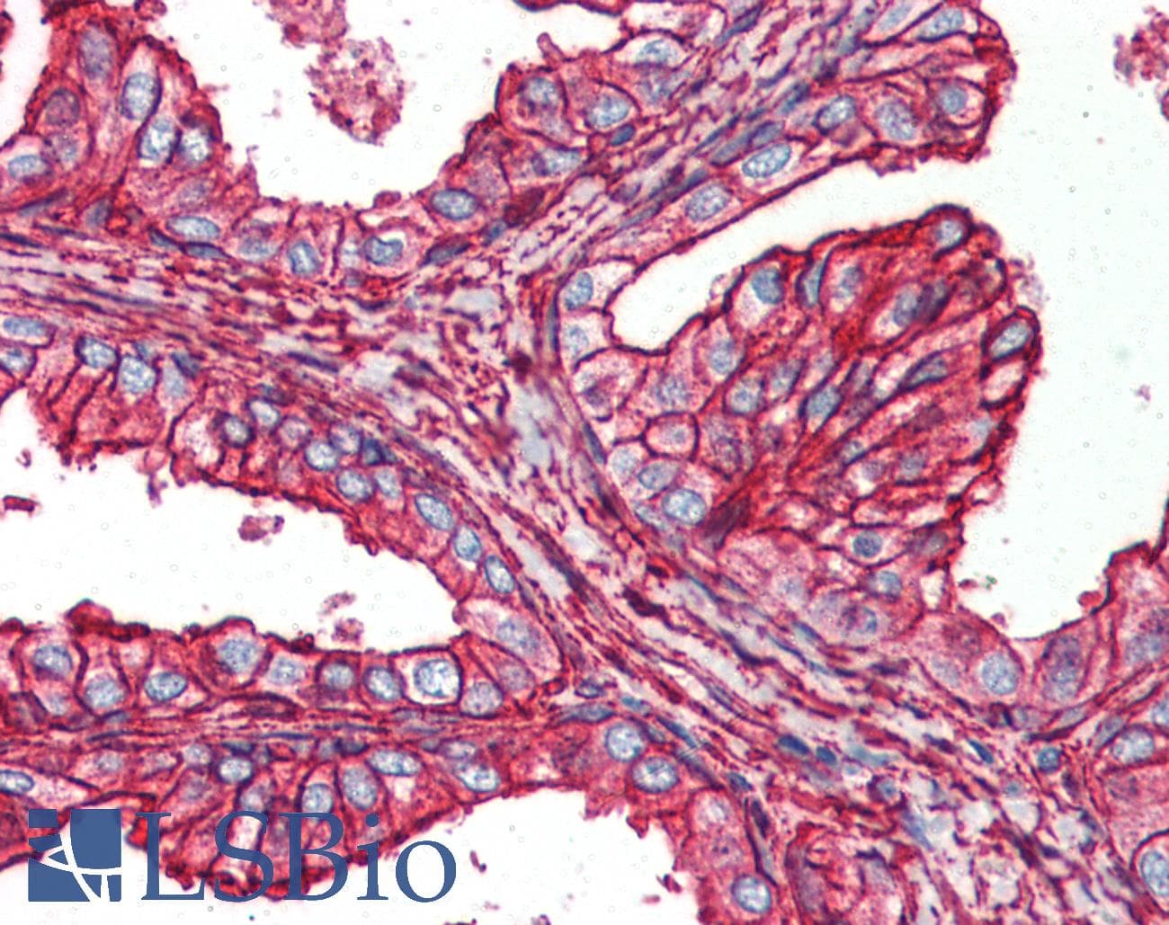 IHC-plus™ Polyclonal Rabbit anti-Human HSPB6 / HSP20 Antibody (IHC, WB)