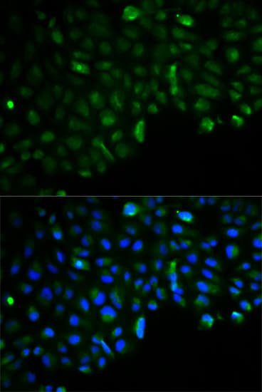 IHC-plus™ Polyclonal Rabbit anti-Human HK2 / Hexokinase 2 Antibody (IHC, IF, WB)