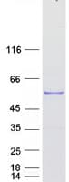 Human TSPYL4 Protein (Recombinant Myc-DDK (Flag))