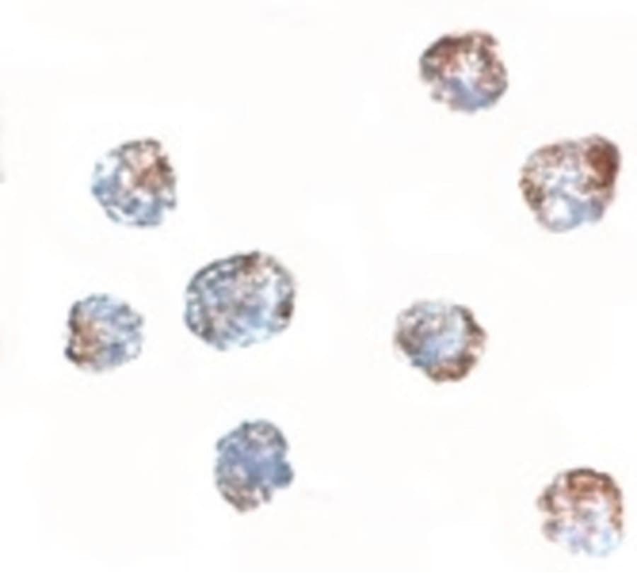 Polyclonal Rabbit anti-Human MATN3 / Matrilin 3 Antibody (IF, WB)