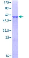 Human C1QTNF1 / CTRP1 Protein (Recombinant GST)