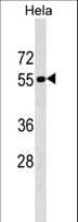 Polyclonal Rabbit anti-Human EEYORE / TIGD1 Antibody (aa123-149, WB)