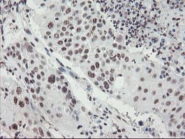 MLF2 Antibody (clone OTI1E3)