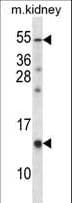 RAMP3 Antibody (aa90-118)
