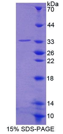 Human SPIN / SPIN1 Protein (Recombinant His-T7)