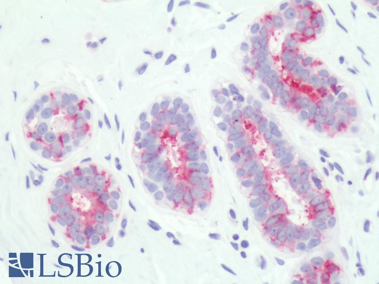 IHC-plus™ Polyclonal Rabbit anti-Human PTGER3 / EP3 Antibody (Cytoplasmic Domain, IHC)