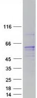 Human RCBTB1 Protein (Recombinant Myc-DDK (Flag))