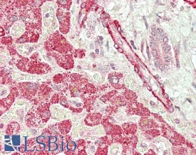 PathPlus™ Polyclonal Rabbit anti-Human ACVR2 / ACVR2A Antibody (aa45-305, IHC, WB)