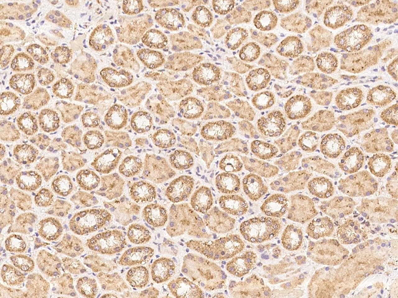 ZNF804B Antibody