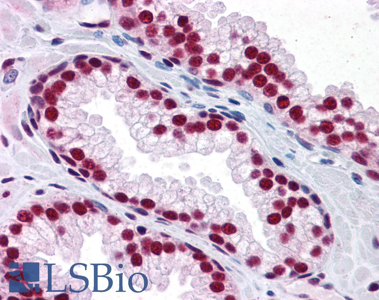 IHC-plus™ SAFB1 / SAFB Antibody (clone 5A11)