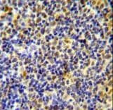 IKZF1 / IKAROS Antibody (aa415-444)