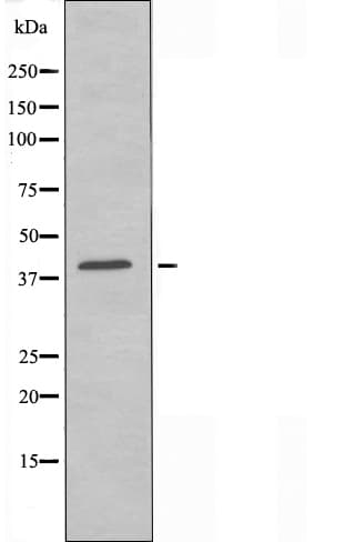 ACTBL2 Antibody