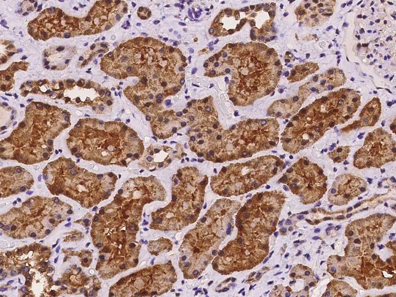 GRHPR / Glyoxylate Reductase Antibody
