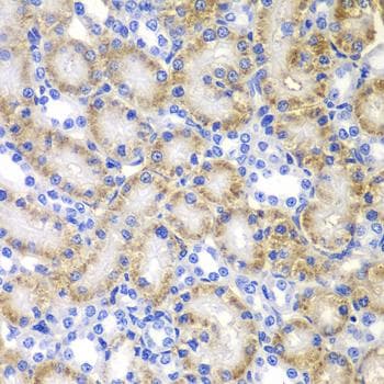 RARB / RAR Beta Antibody