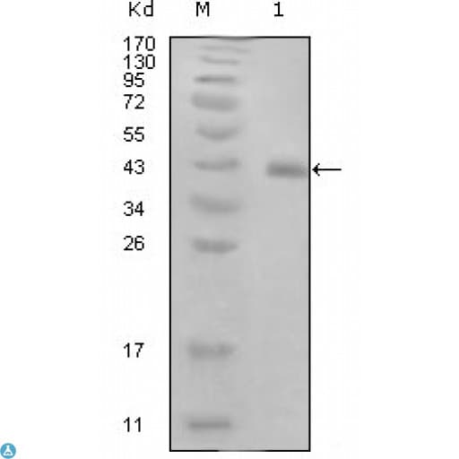 HPV11 E7 Antibody (clone 3D6F1)