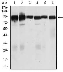 Monoclonal Mouse anti-Human Betaglycan / TGFBR3 Antibody (clone 1C5H11, aa147-328, WB)