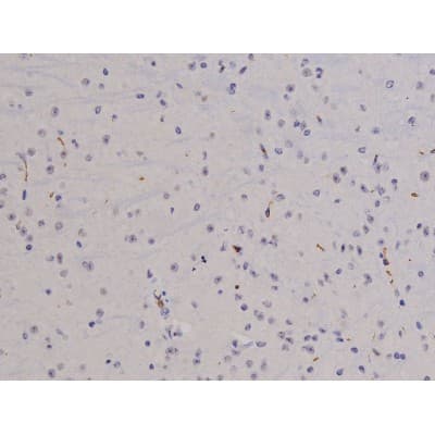 FAK / Focal Adhesion Kinase Antibody (phospho-Tyr576)
