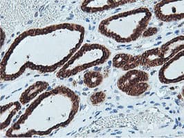 APMAP / C20orf3 Antibody (clone OTI1D7)