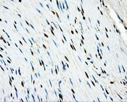 LOX / Lysyl Oxidase Antibody (clone OTI9G6)