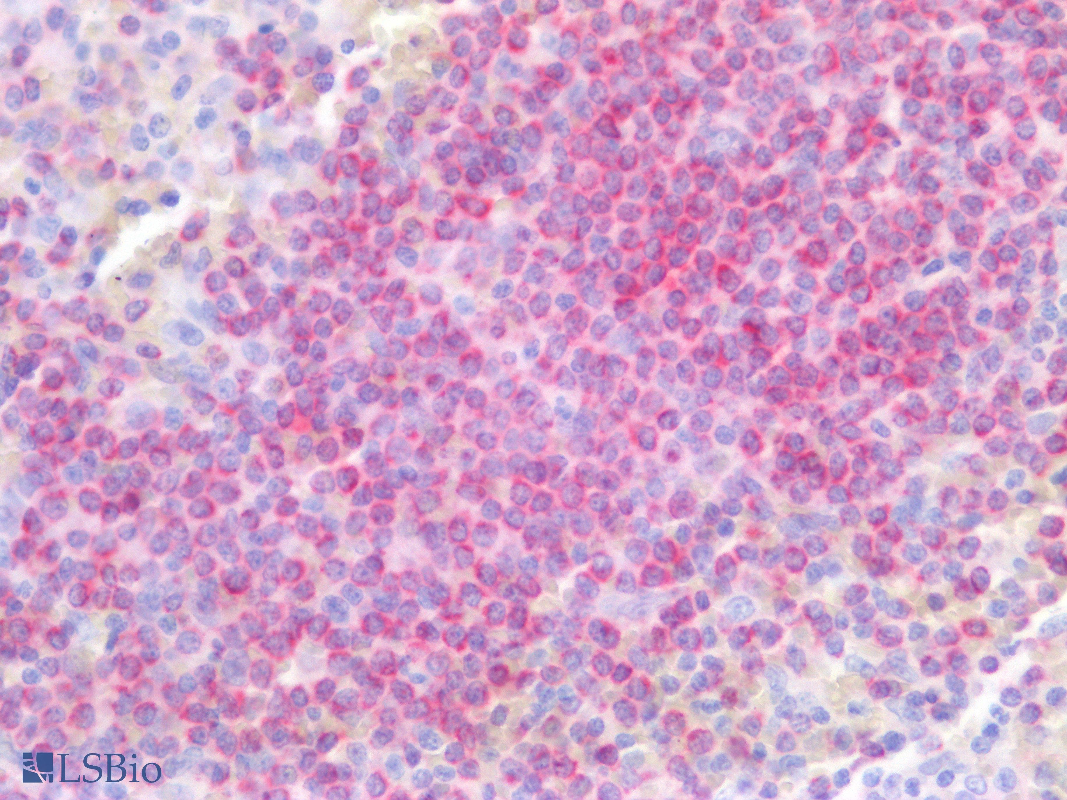 PathPlus™ Monoclonal Mouse anti-Human BCL2 / Bcl-2 Antibody (clone 124, aa41-54, IHC, IF, WB)