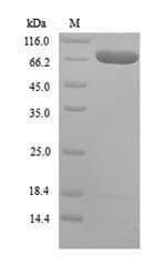 Mouse ARID5A Protein (Recombinant 6His, N-terminus)