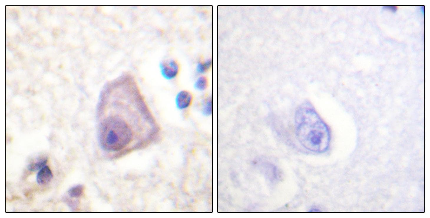 MAP2K4 / MKK4 Antibody (phospho-Ser257)