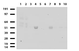 CHGA / Chromogranin A Antibody (clone UMAB109)