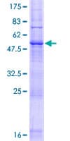Human LAPTM5 Protein (Recombinant GST)